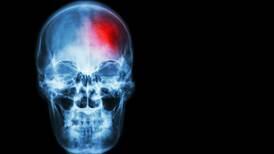 ¡Cuidado! Los adultos mayores pueden tener un derrame cerebral en el tercer día de contagio por Covid-19
