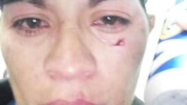 Mujer árbitro fue agredida tras expulsar a jugador en liga amateur de Puebla