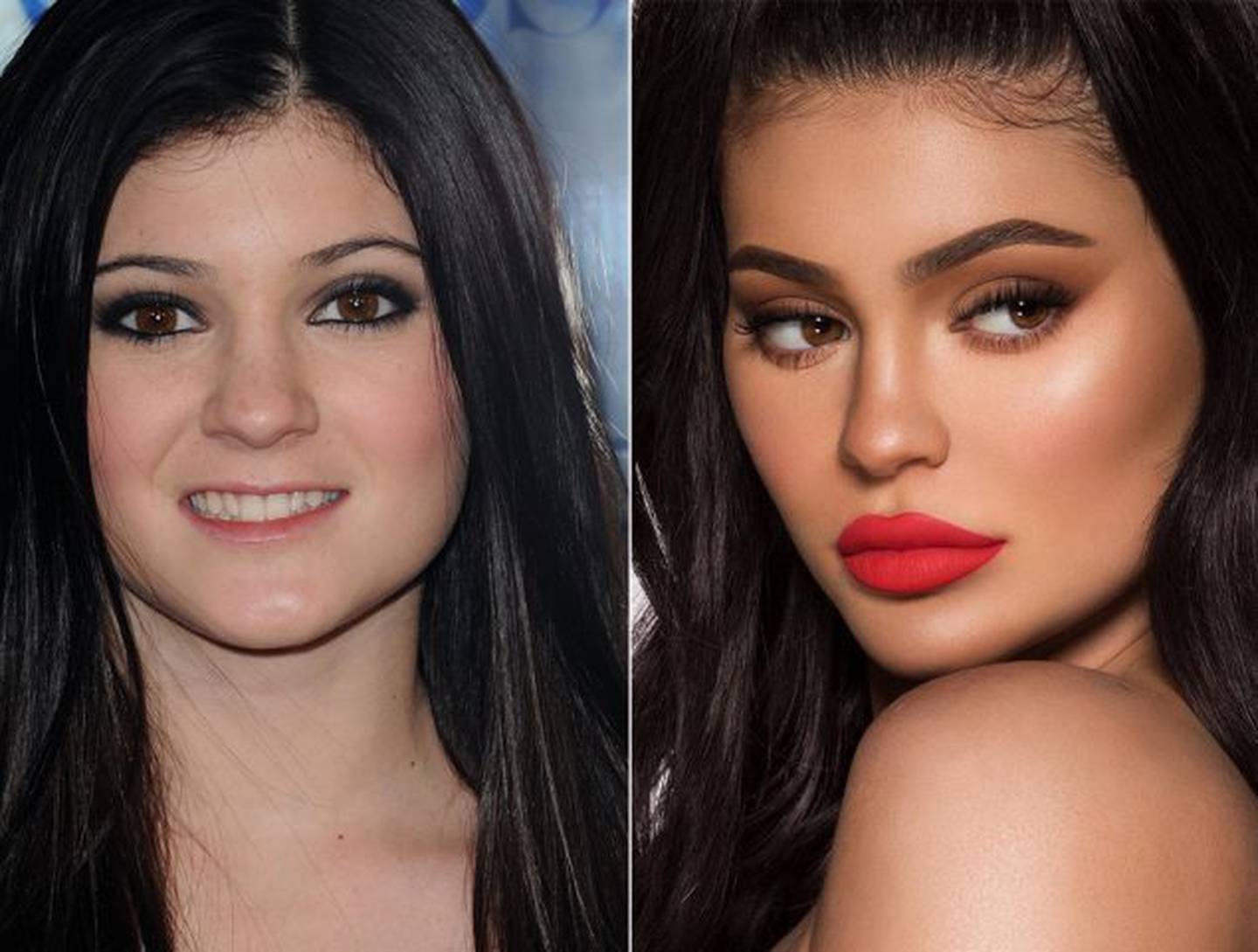 Kylie Jenner antes y después.