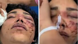 Fanático se hizo tatuaje del rostro golpeado de Paola Suárez, en apoyo a la integrante de “Las Perdidas”
