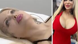 Video: Sabrina Sabrok vuelve a ser virgen gracias a este tratamiento