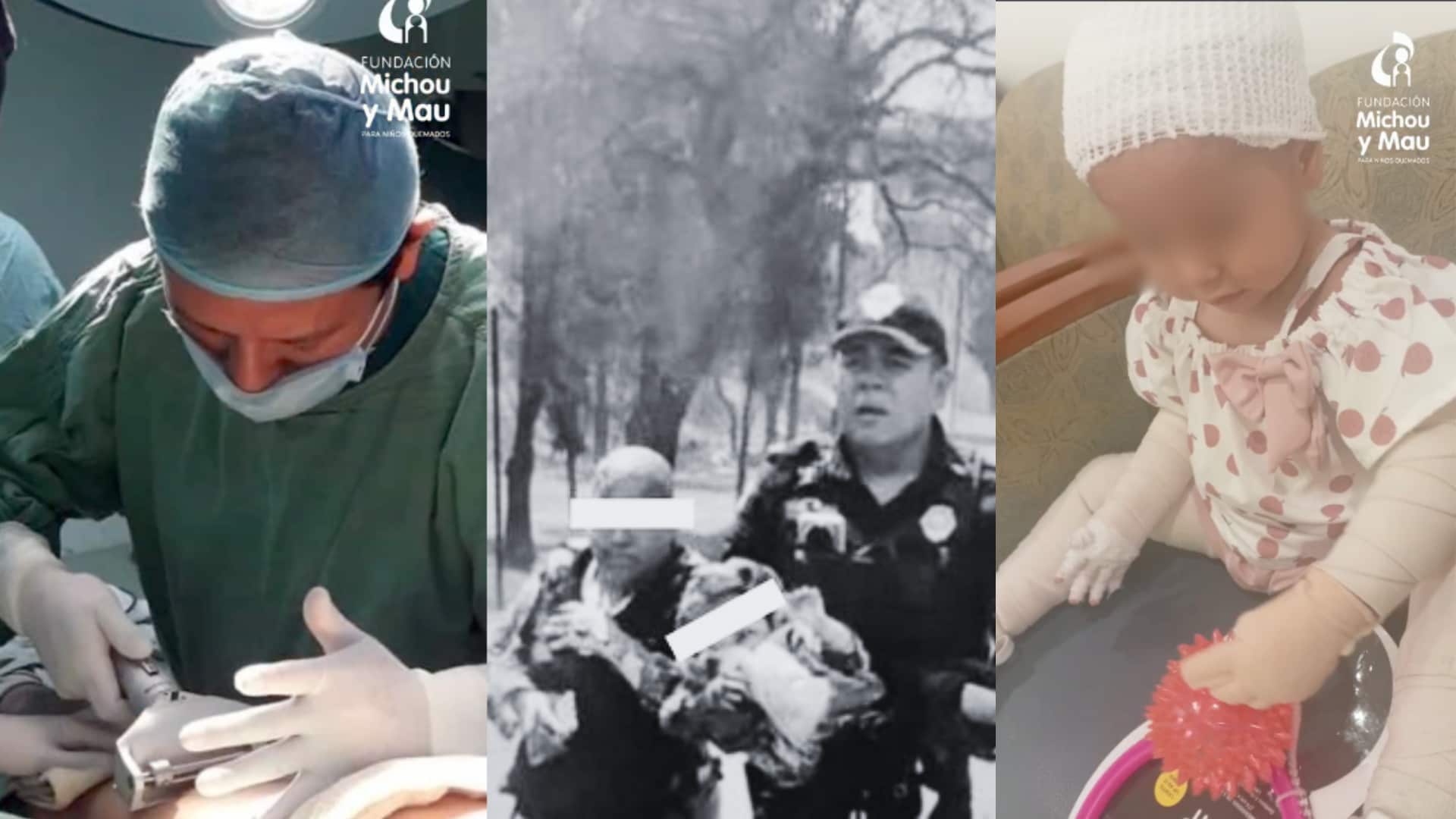 Tras ser sometida a cirugías de injertos por quemaduras graves, Jazlyn Azulet inicia su rehabilitación física bajo supervisión especializada