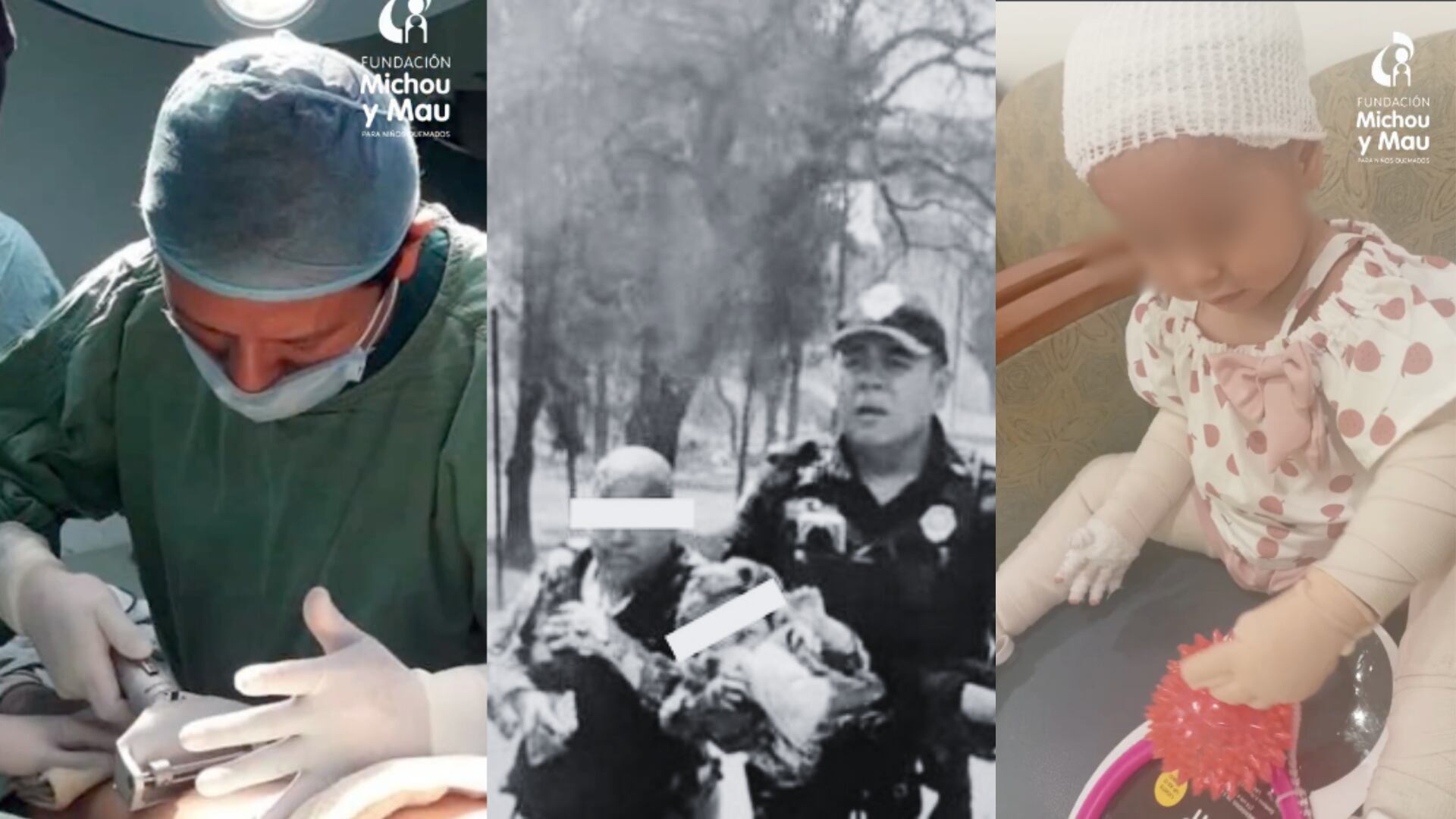 Tras ser sometida a cirugías de injertos por quemaduras graves, Jazlyn Azulet inicia su rehabilitación física bajo supervisión especializada