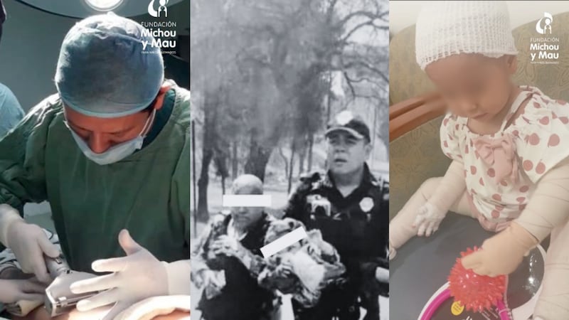 Primeras imágenes de Jazlyn Azulet, la niña de 2 años que sobrevivió a explosión de pipa