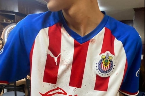 Barra del Atlas propinó golpiza a un menor de edad aficionado de Chivas en el clásico tapatío