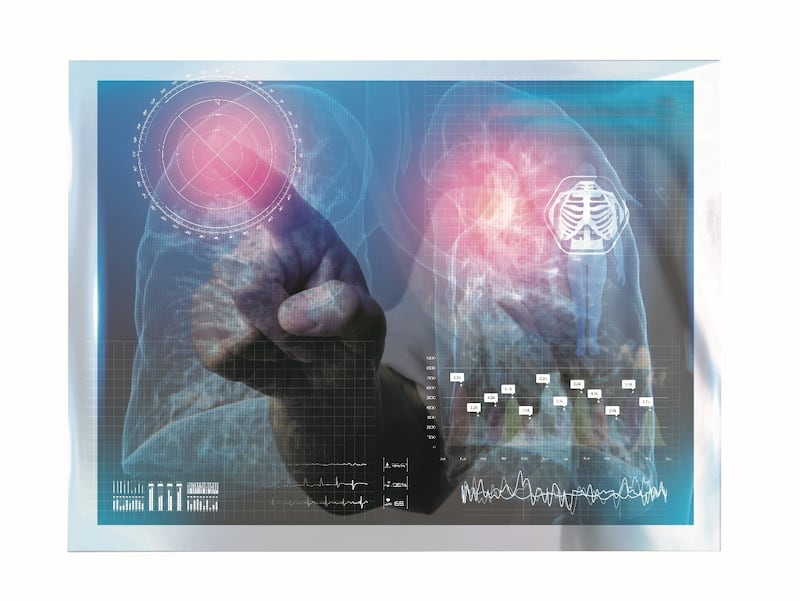 Slaud, Aztra Zeneca, pulmones, cáncer pulmonar