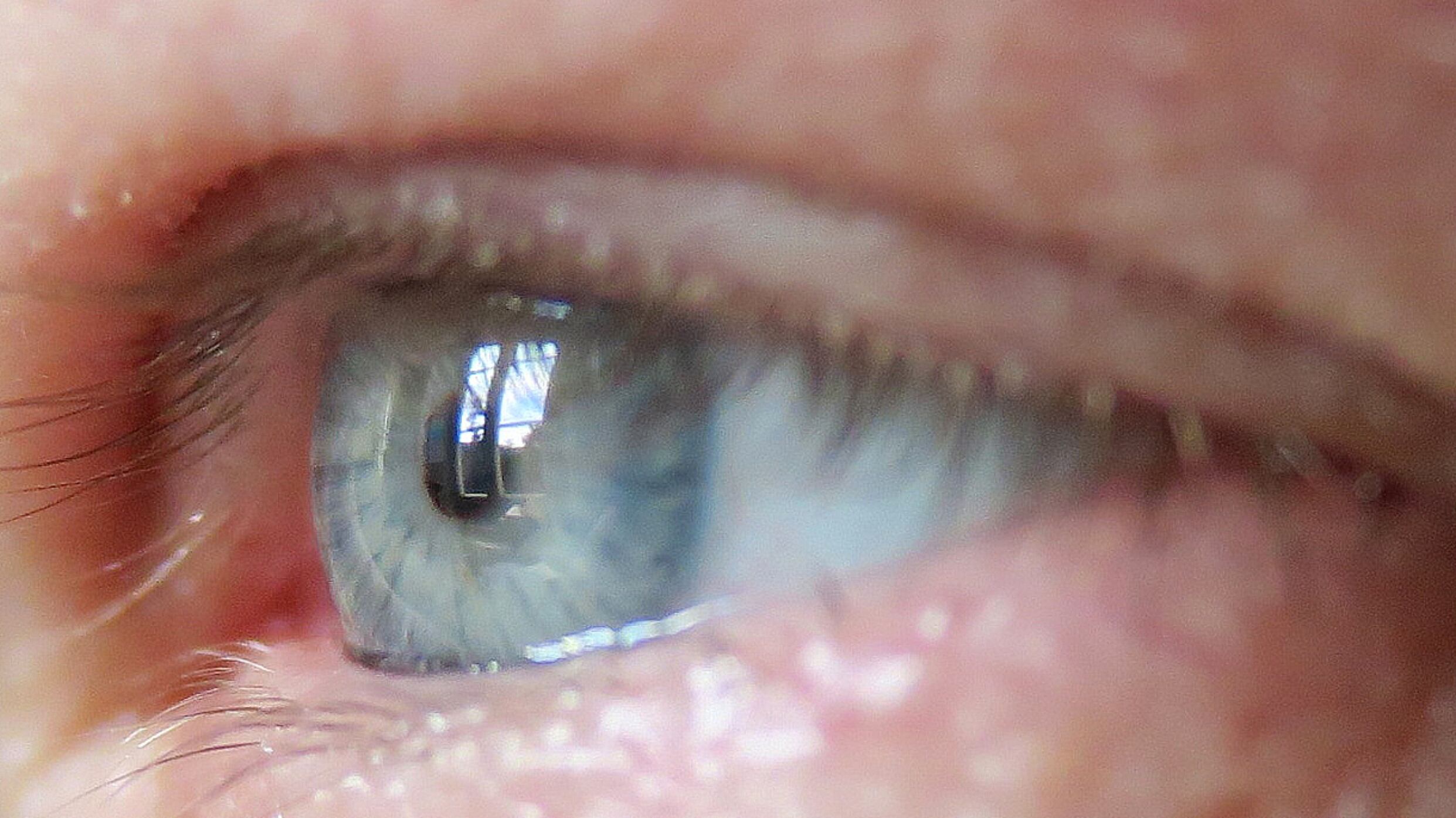 Implante ocular