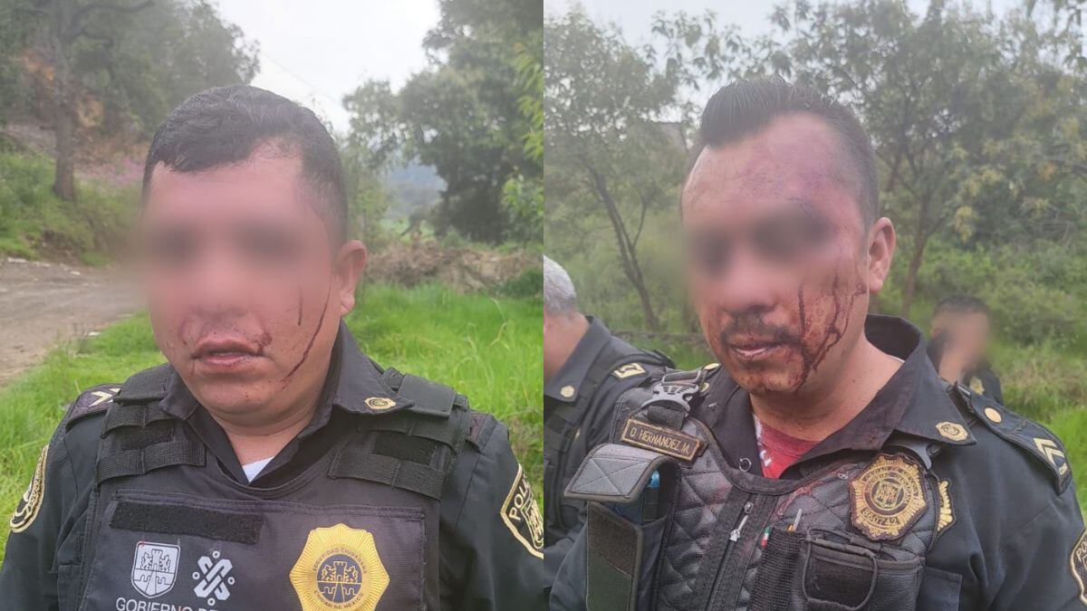 Agreden a policías de la SSC en Xochimilco