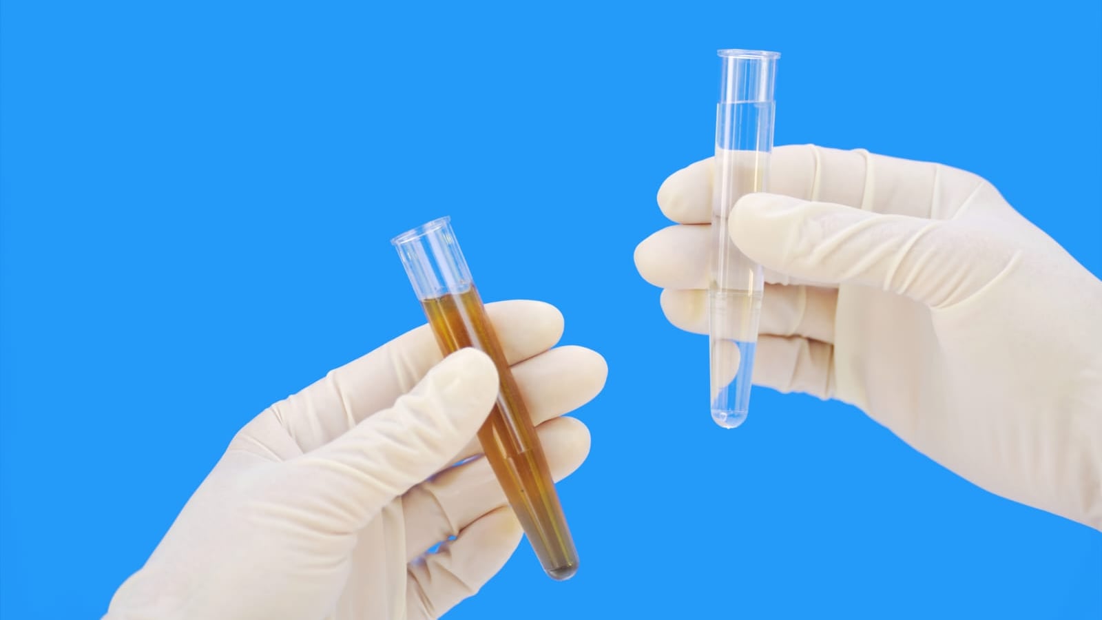 El estudio realizado por la facultad se hizo conforme a la norma mexicana.