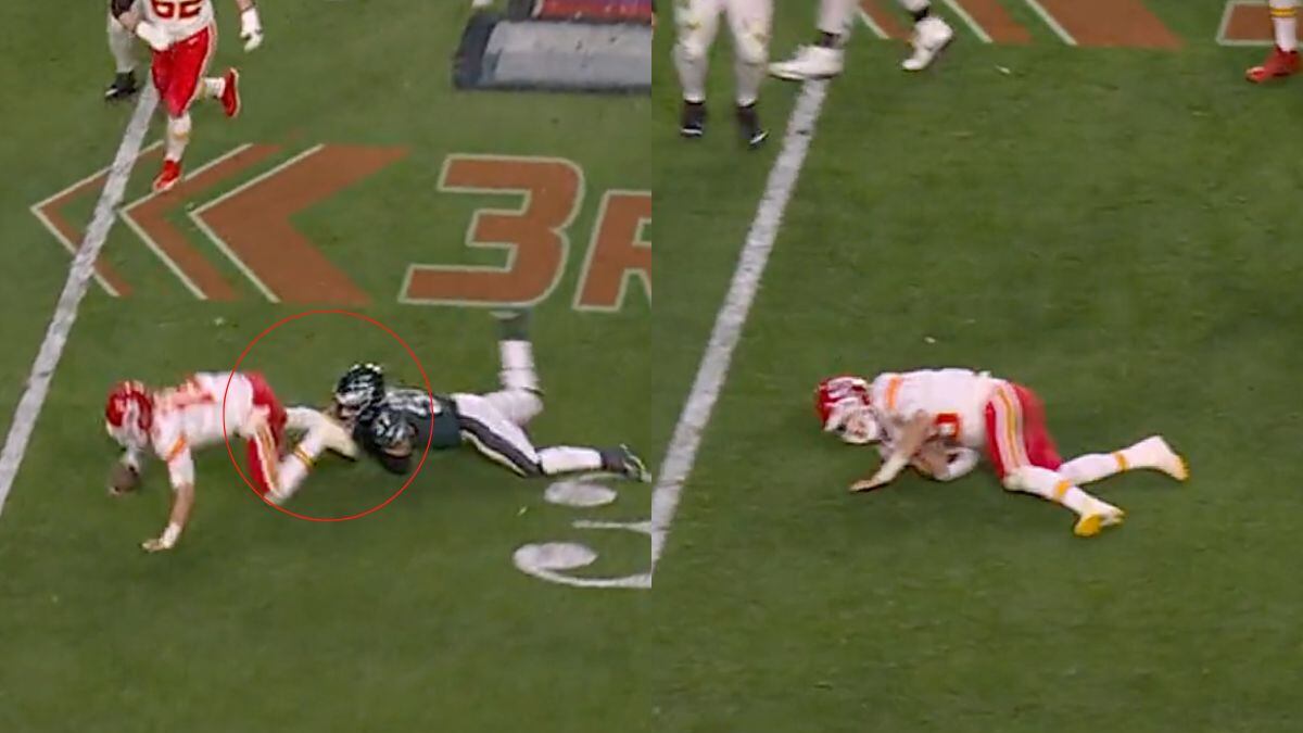 Lesion Patrick Mahomes