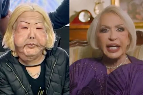 Laura Bozzo explota tras falsa noticia de que se había desfigurado el rostro