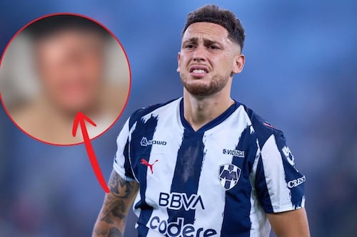 Lucas Ocampos sufre terrible parálisis facial; así quedó su cara