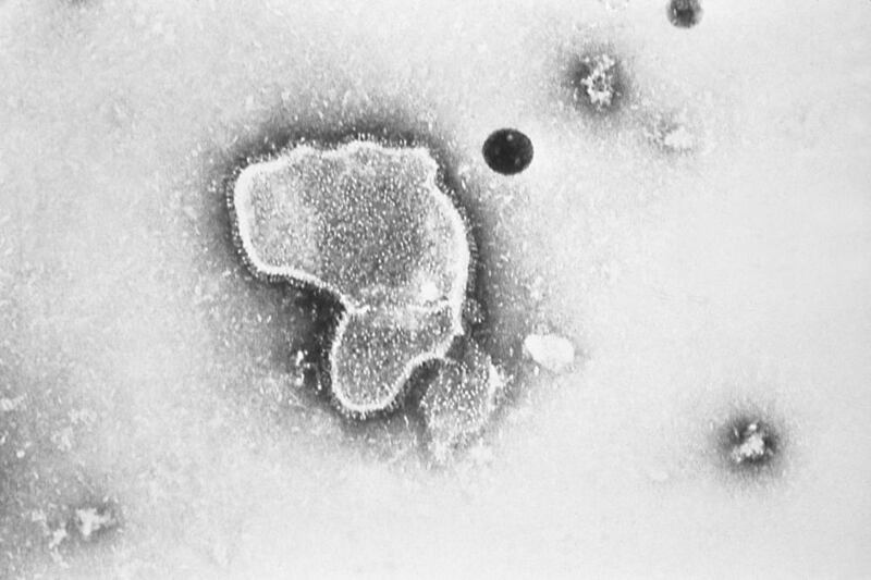 Imagen del virus respiratorio sincitial (VRS). | Imagen: Centros para el Control y Prevención de Enfermedades (CDC) vía AP.