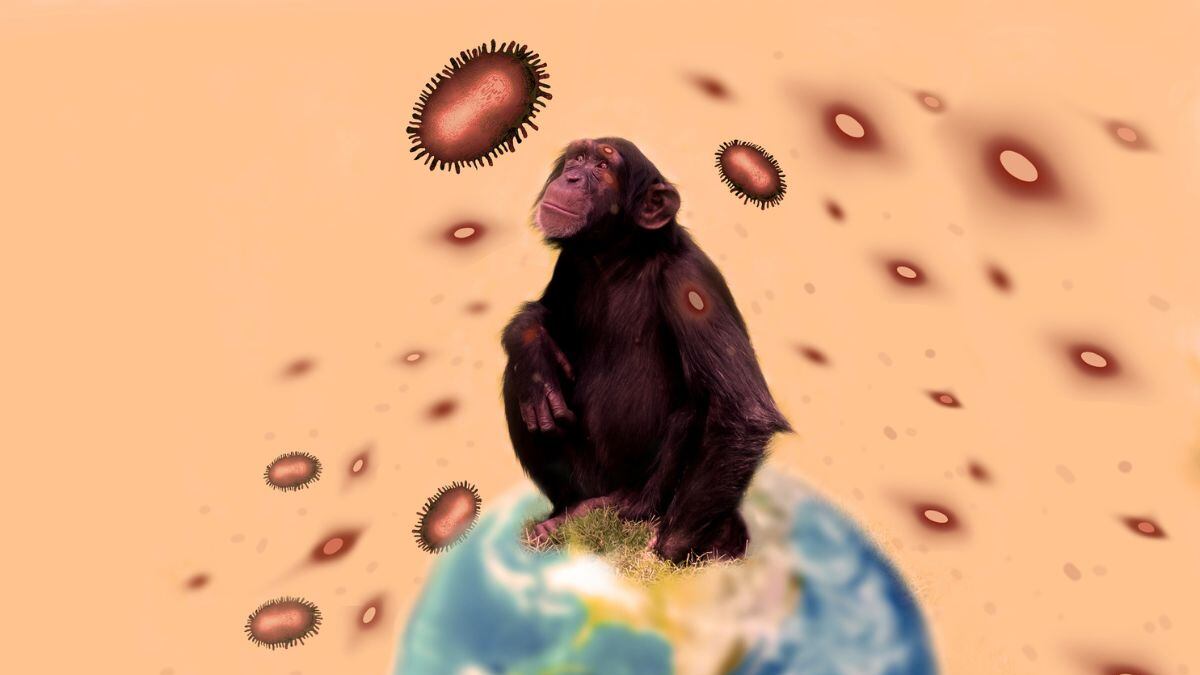 ¿Aumento de casos por viruela del mono a nivel mundial podrían desencadenar otra pandemia?