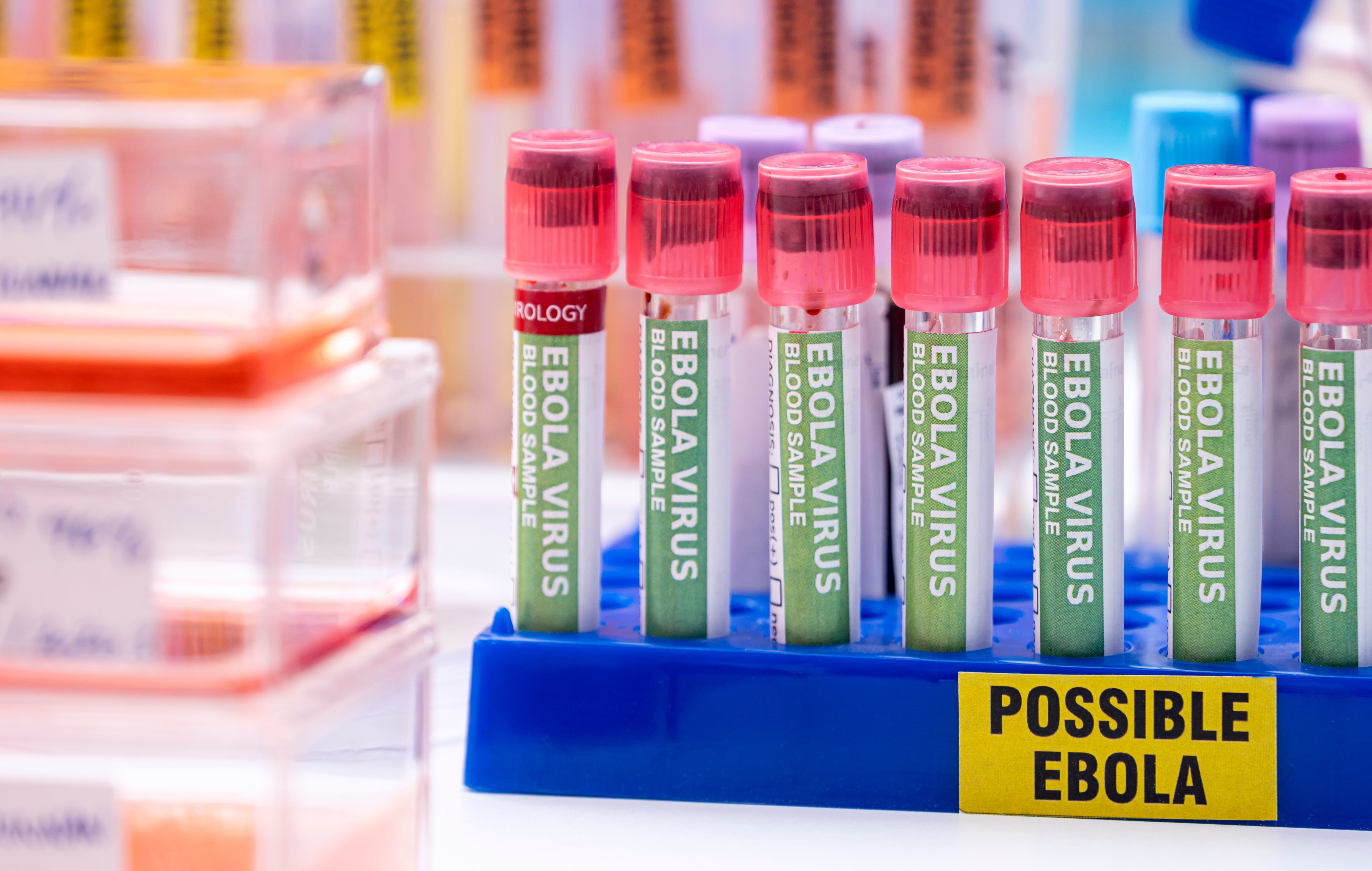 Estados Unidos endurece restricciones de viaje por brote de ébola en África 