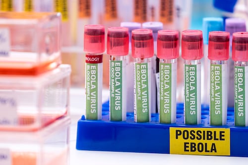 Estados Unidos endurece restricciones de viaje por brote de ébola en África