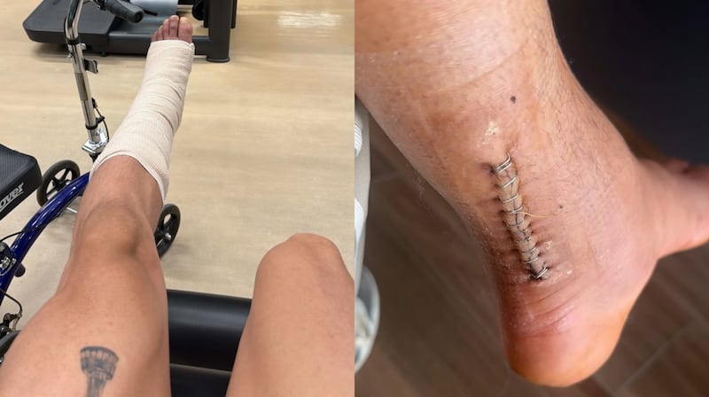 Secuelas de operación de Malagón.