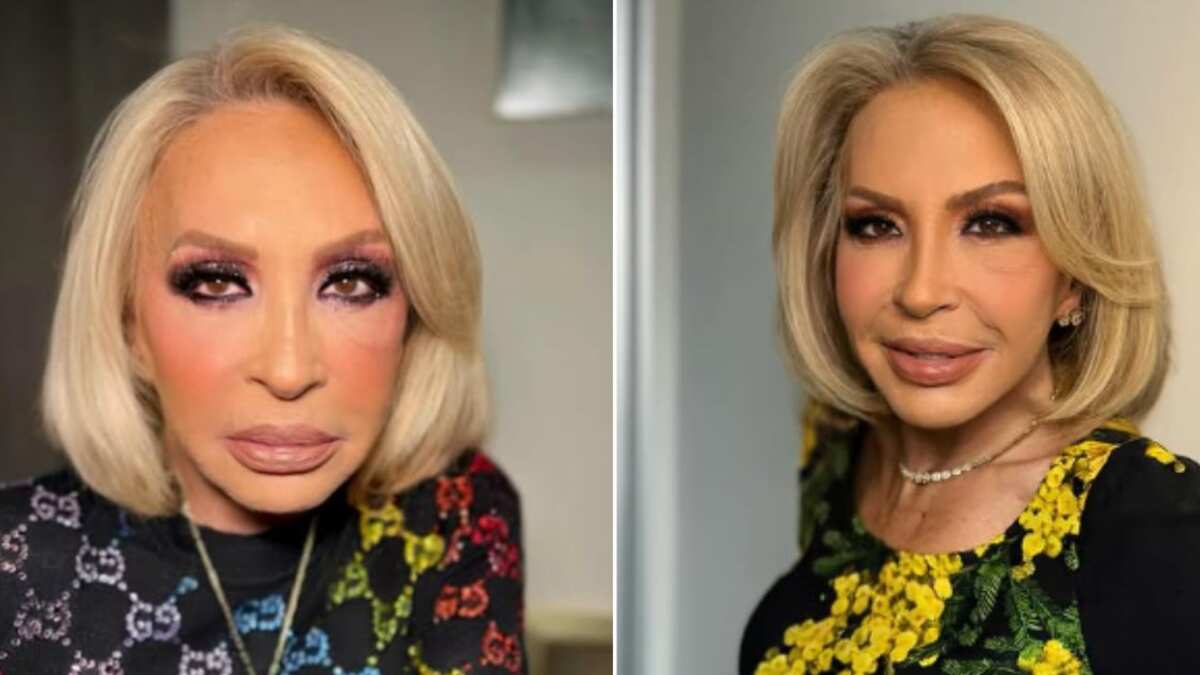 Laura Bozzo le hace la guerra a las arrugas: “Necesito quitarme la cara de momia”