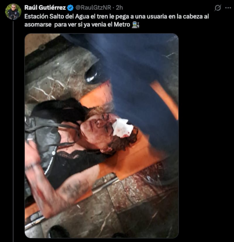 Mujer es arrollada por el Metro