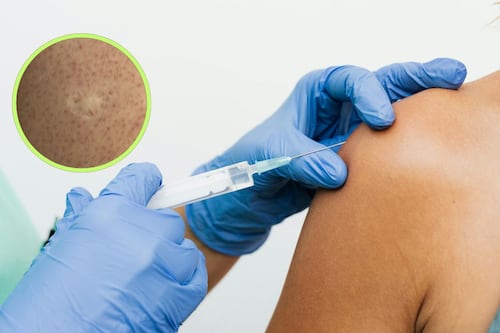 Cicatriz en el hombro no es del sarampión: Sheinbaum aclara el mito en plena alerta sanitaria