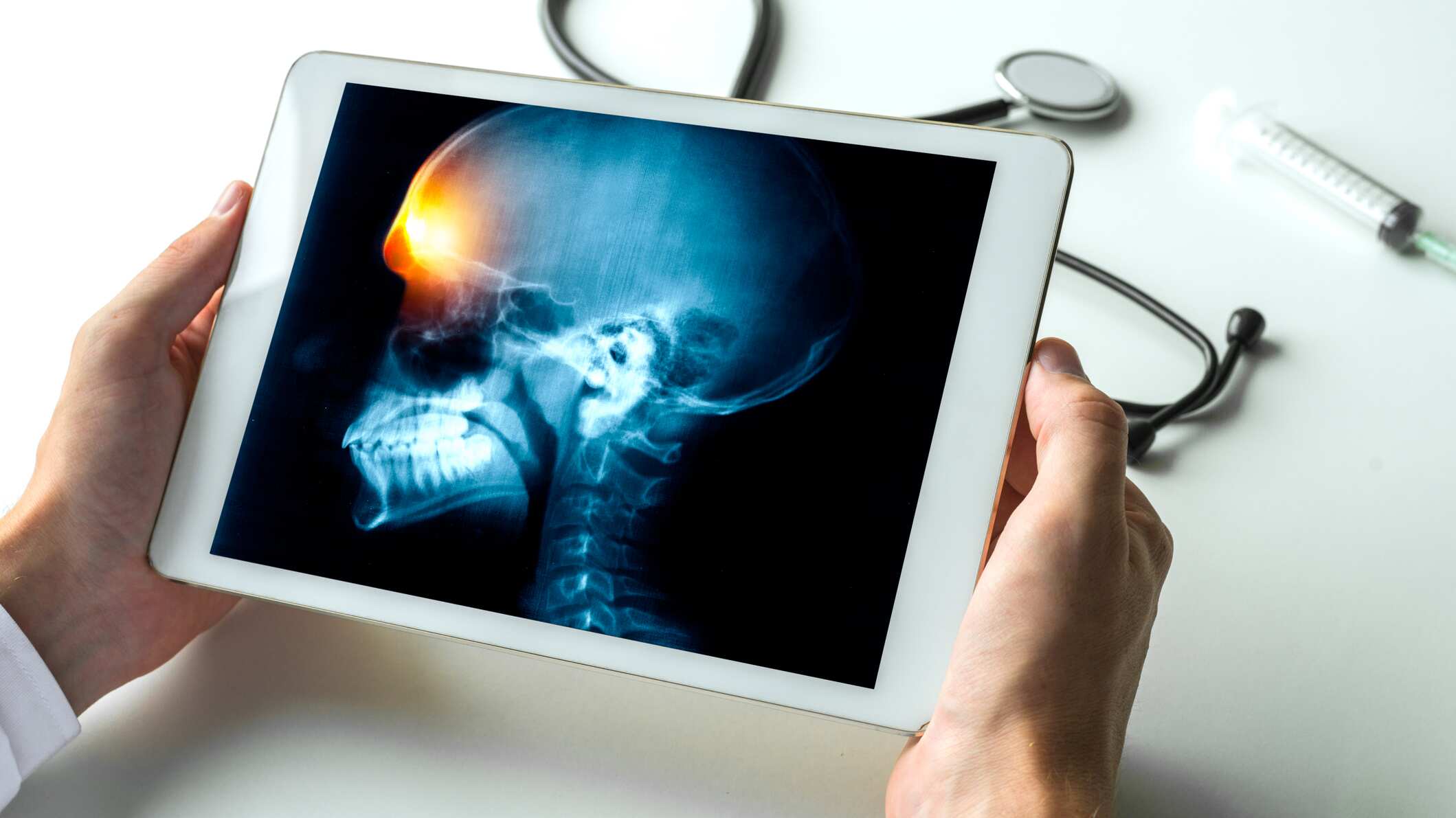 La enfermedad ha provocado 21 muertes hasta el momento. (Dreamstime)