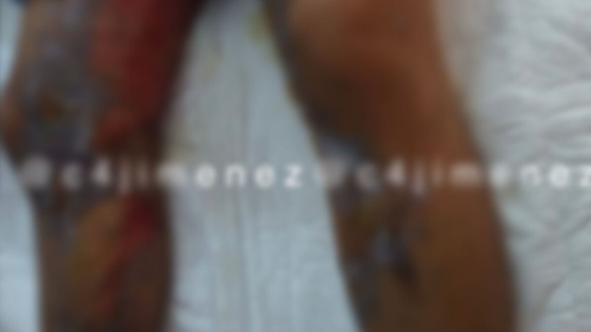 Compañeros prenden fuego a alumno de prepa en Texcoco, Edomex.