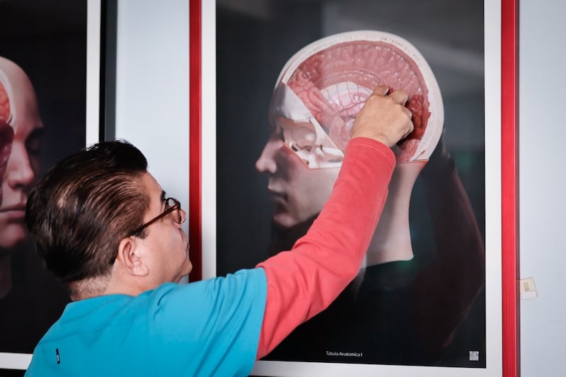 Retiran tumor cerebral a paciente que permaneció despierta en operación