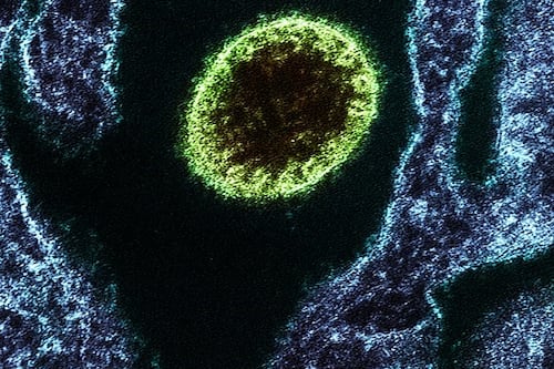 Henipavirus Langya, el nuevo virus de origen animal que registra 35 infectados en China 
