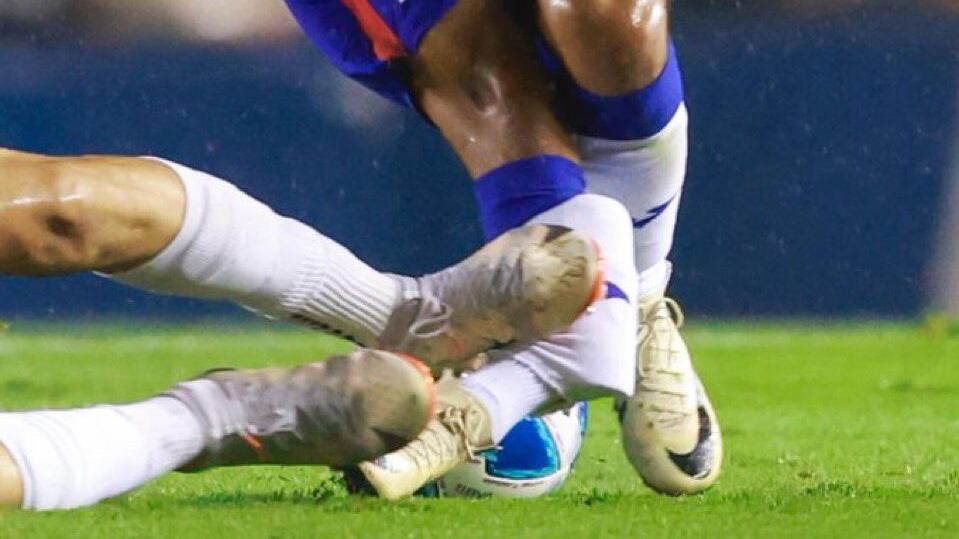 Hobbit Bermúdez sufrió brutal agresión en la Liga de Expansión.