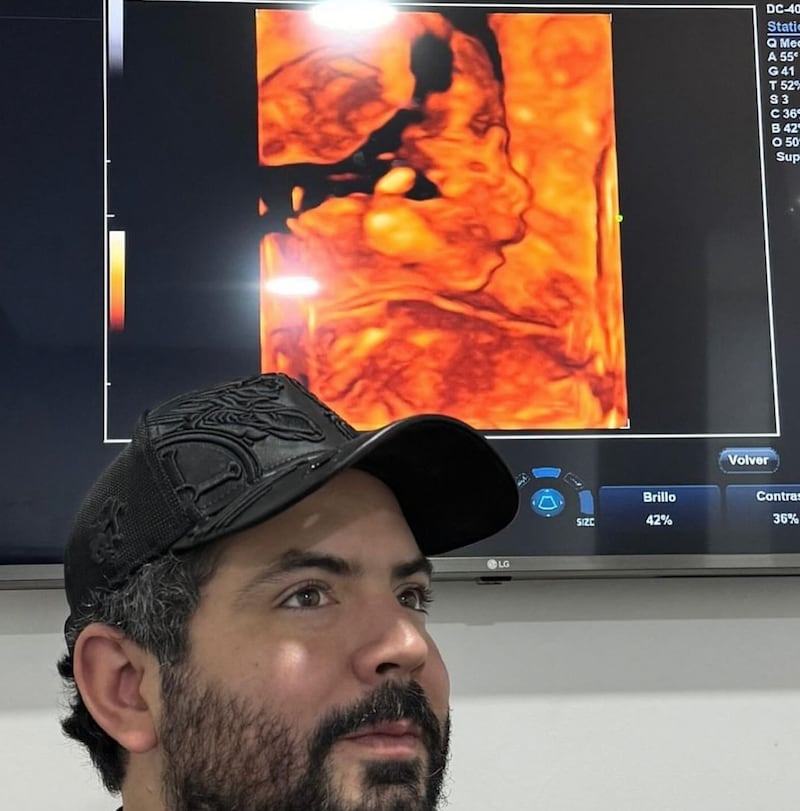 José Eduardo Derbez