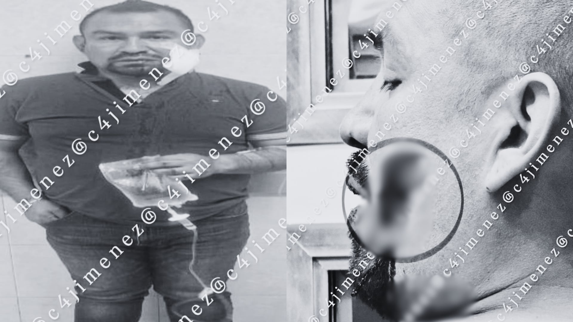 Fotografías difundidas muestran la lesión facial del presunto agresor y a ambos hombres bajo custodia policial.