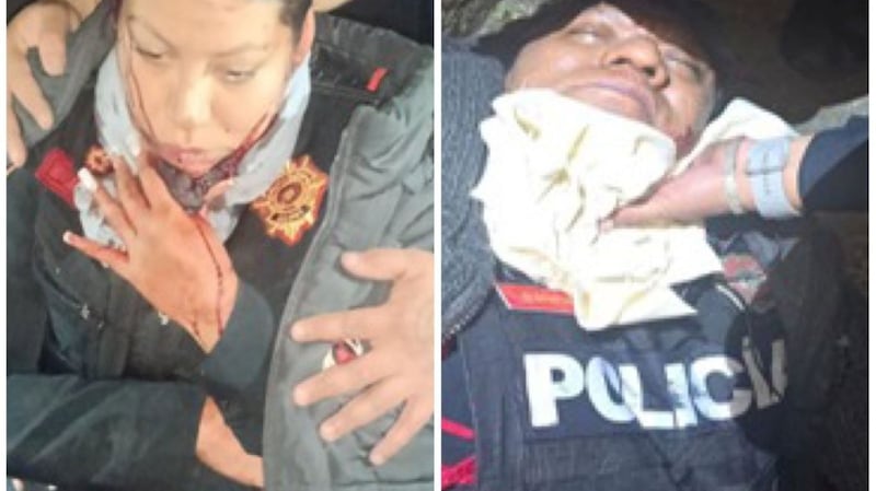 Elemento de la PBI lesionada en el cuello