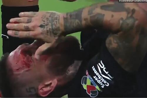 VIDEO: Sergio Ramos recibe brutal patada en el rostro que lo deja sangrando