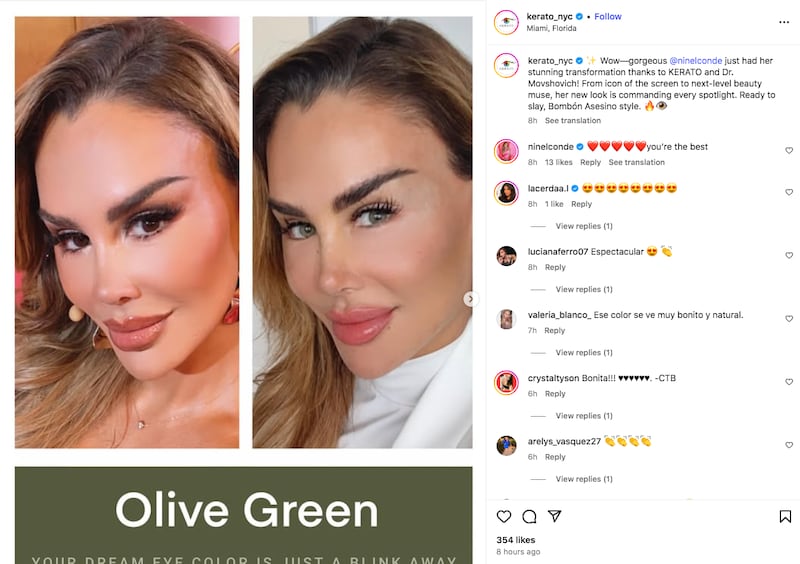 Clínica Kerato sobre el cambio de imagen de Ninel Conde