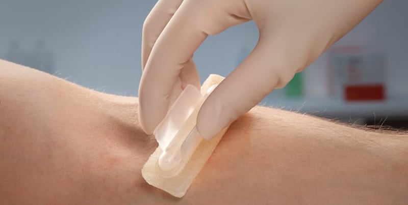 Antiséptico en donación de sangre