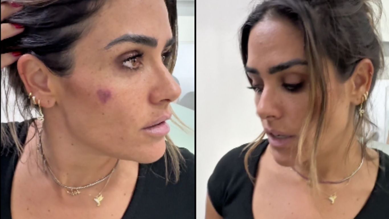 Ataque a Alessandra Rojo de la Vega