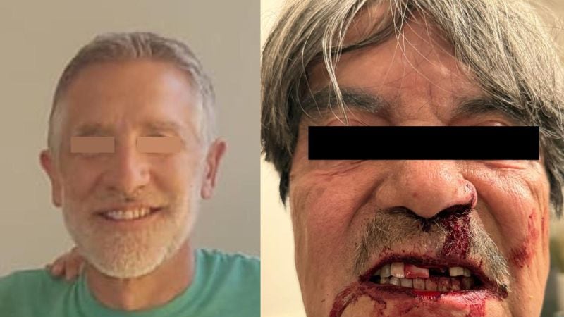 Francés golpea salvajemente a científico mexicano en Irapuato