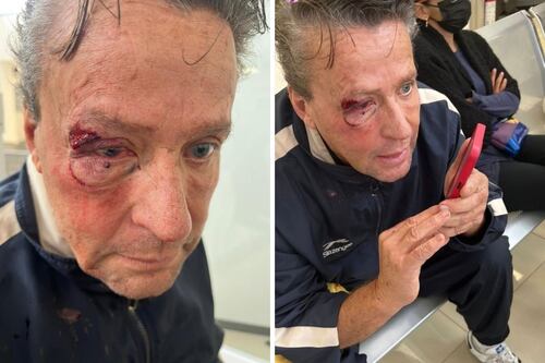 Alfredo Adame sufre desprendimiento de retina en un ojo tras recibir brutal golpiza