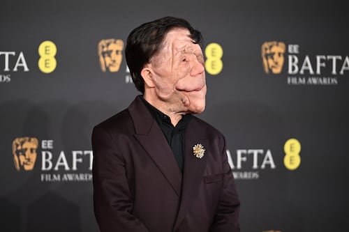 ¿Qué es la neurofibromatosis, condición que padece el actor Adam Pearson?
