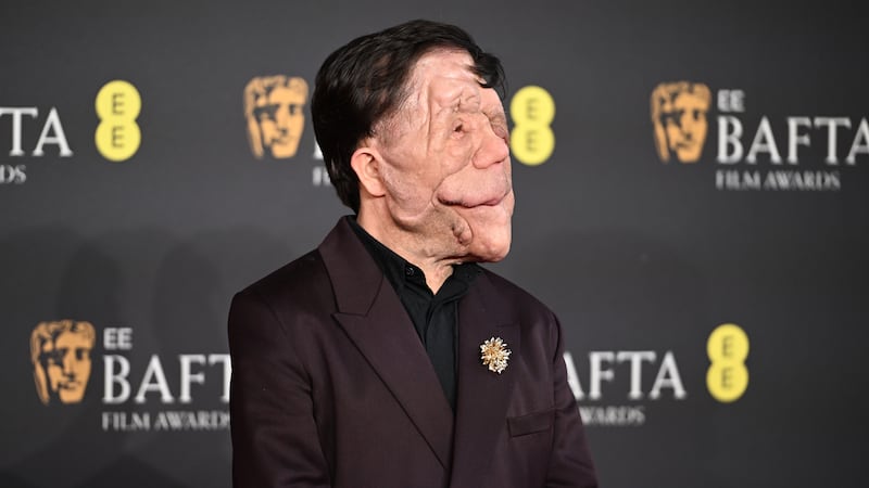 ¿Qué es la neurofibromatosis, condición que padece el actor Adam Pearson?