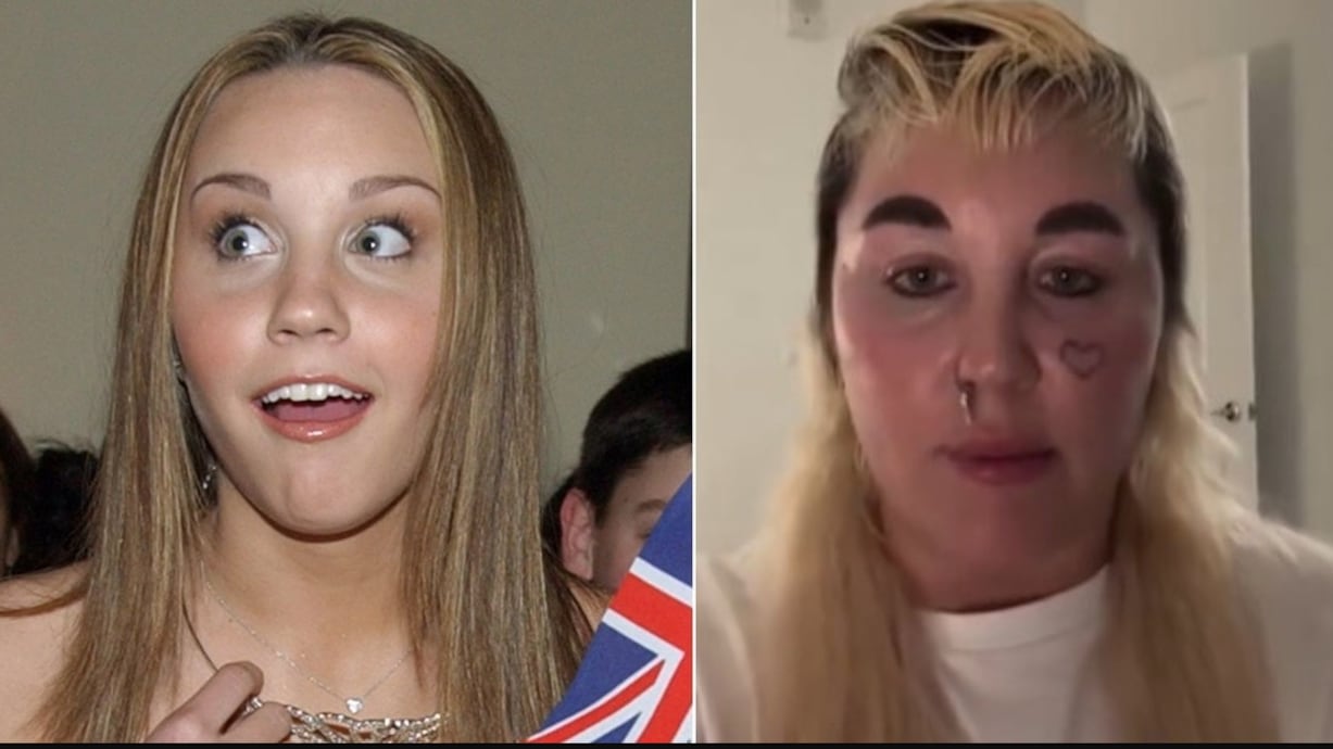 Antes y después Amanda Bynes
