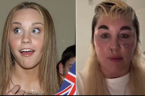 De Nickelodeon a página azul: la sorprendente transformación física de Amanda Bynes