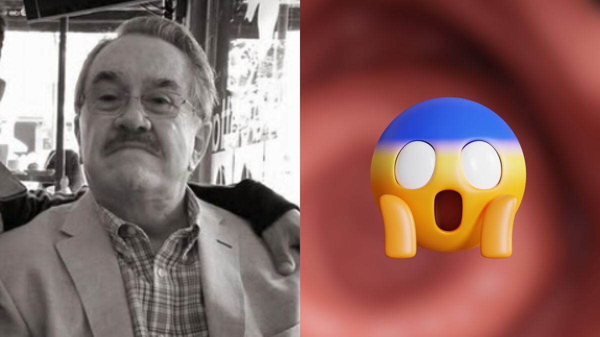 ¿Qué es un pólipo? El problema de salud que llevó a Pedrito Sola al quirófano de emergencia