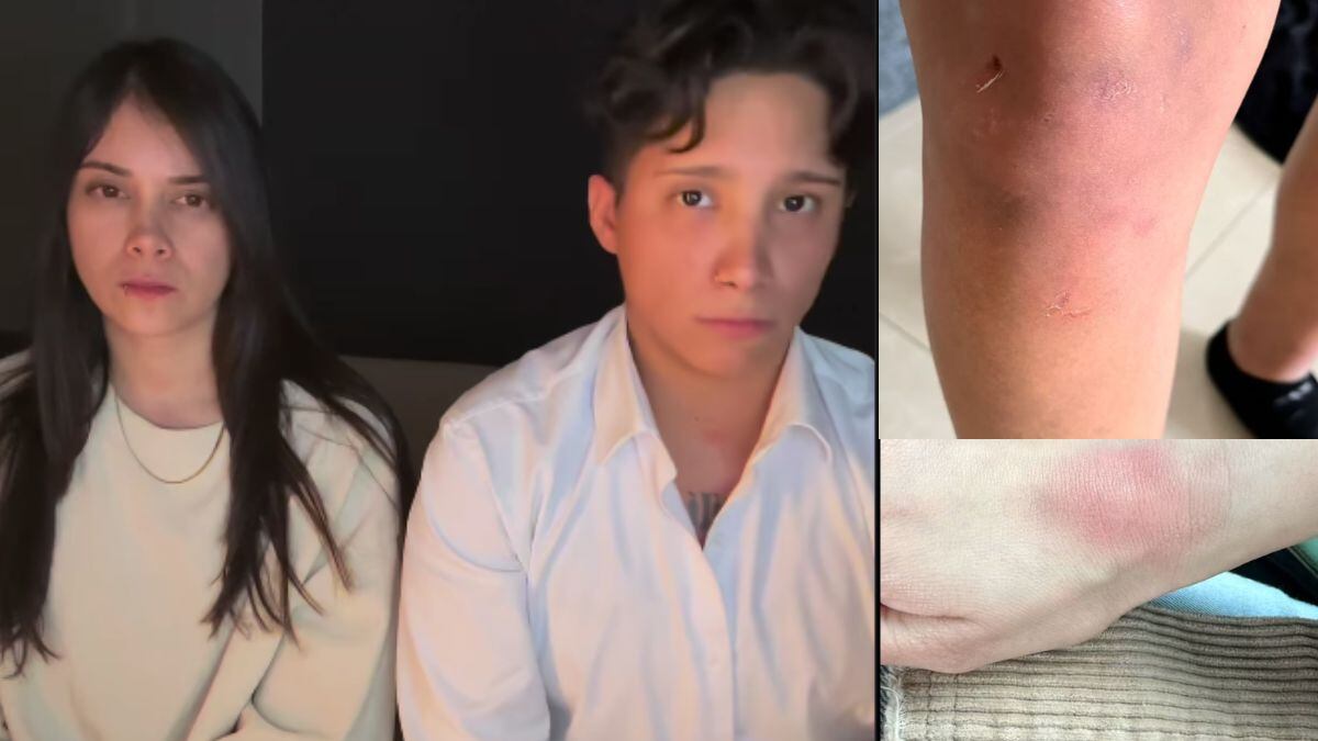 Policías de Monterrey someten y golpean a pareja de mujeres LGBT.
