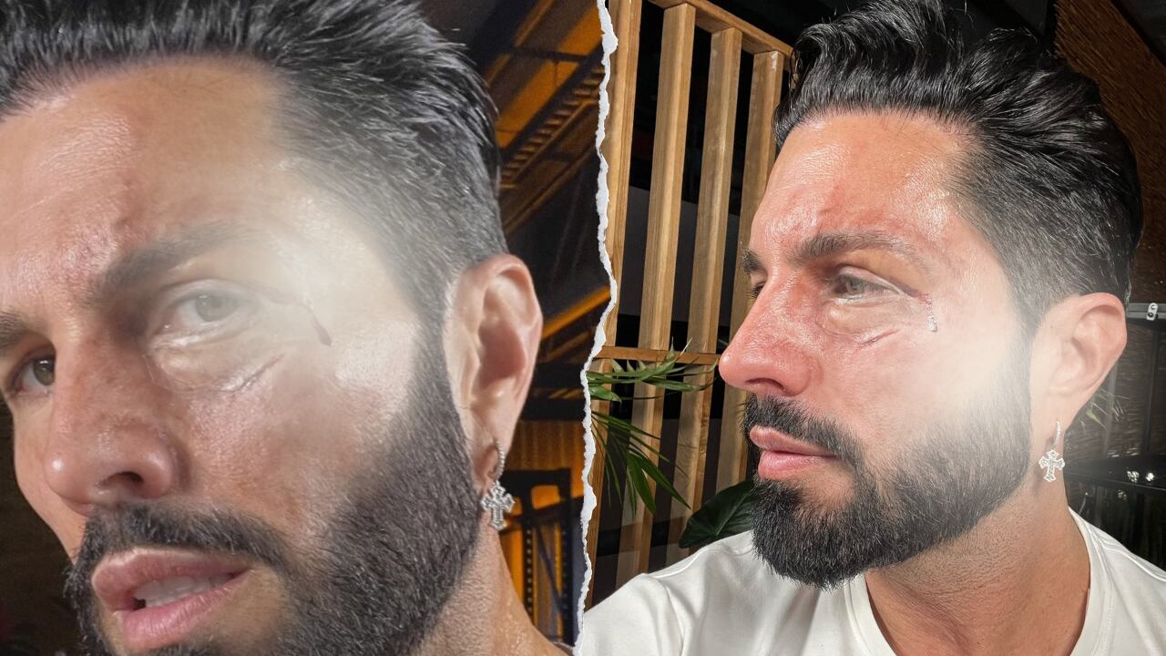 ¿De Nigris fue golpeado?