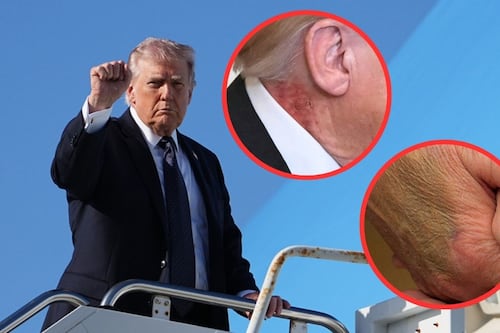 ¿Trump está en riesgo de muerte por una insuficiencia venosa crónica y sus hábitos?