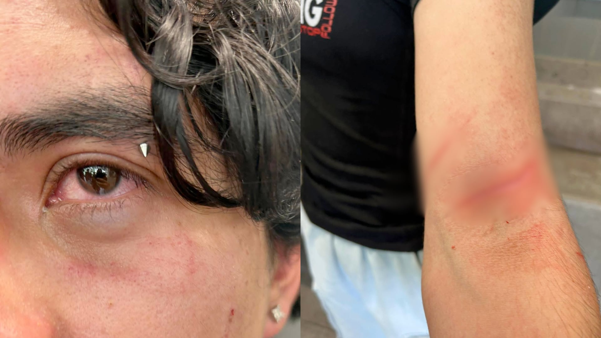Los presuntos agresores aún no han sido identificados, mientras familiares reclaman mayor vigilancia dentro del CCH Sur