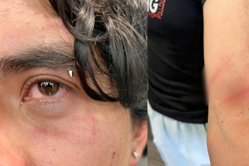 ¿Otro ataque en CCH Sur? Alumno es agredido con navajas en los baños del plantel
