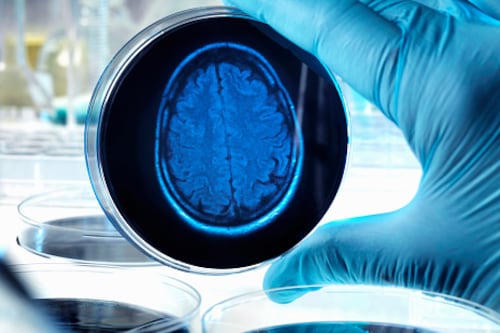 Descubren vínculo del óxido nítrico en el cerebro con el Alzheimer