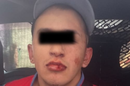 Da un tiro en la cara a sujeto que asesinó a sus dos perritos en la Magdalena Contreras